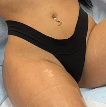Bikini-2a